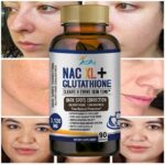 L Glutathione NAC Collagen Skin Whitening Lightening Dark Spots Acne Scar Remova