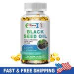 1000mg Black Seed Oil Capsules | Support Joint & Digestive Health 120 Softgels