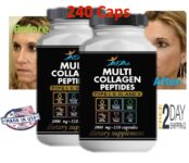 Collagen multi Peptide Capsules 240 Vitamins Colagen hydrolizate Anti Aging skin